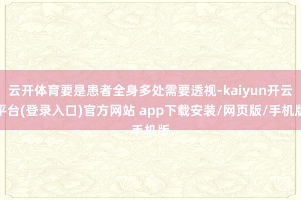 云开体育要是患者全身多处需要透视-kaiyun开云平台(登录入口)官方网站 app下载安装/网页版/手机版